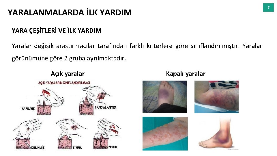 7 YARALANMALARDA İLK YARDIM YARA ÇEŞİTLERİ VE İLK YARDIM Yaralar değişik araştırmacılar tarafından farklı