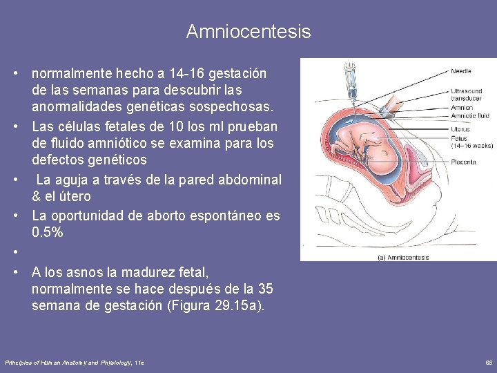 Amniocentesis • normalmente hecho a 14 -16 gestación de las semanas para descubrir las