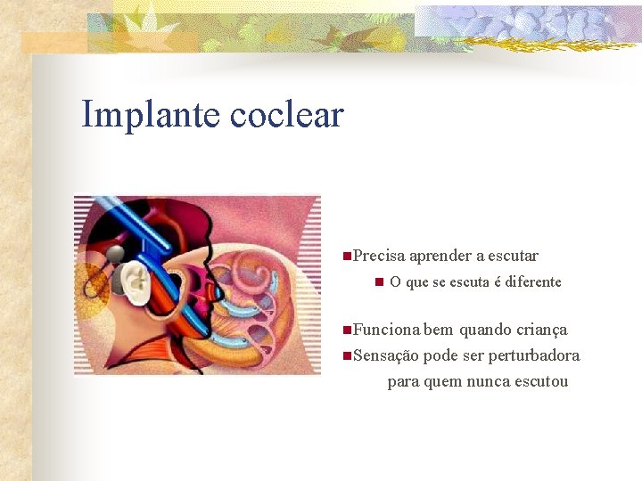 Implante coclear n. Precisa aprender a escutar n O que se escuta é diferente