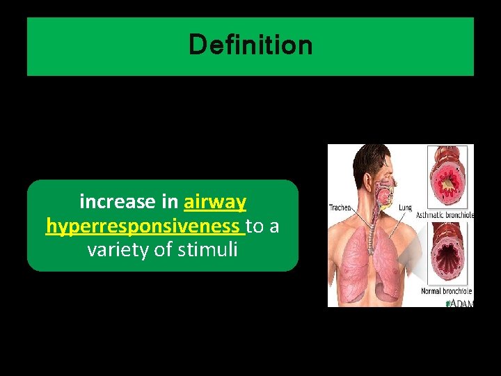 Definition increase in airway hyperresponsiveness to a variety of stimuli 