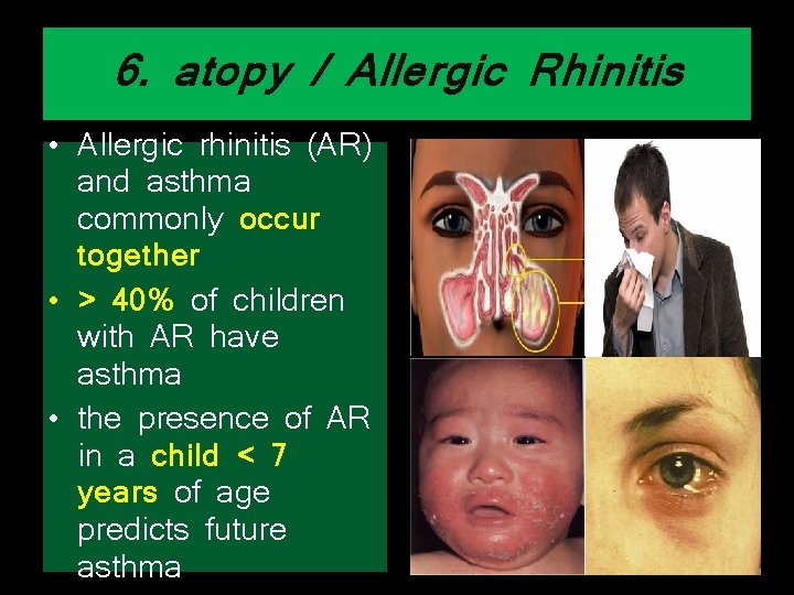 6. atopy / Allergic Rhinitis • Allergic rhinitis (AR) and asthma commonly occur together