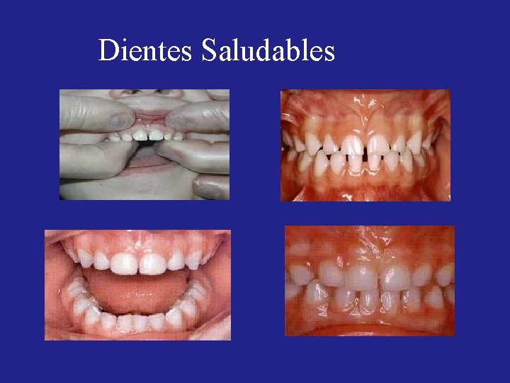 Dientes Saludables Dientes Saludables