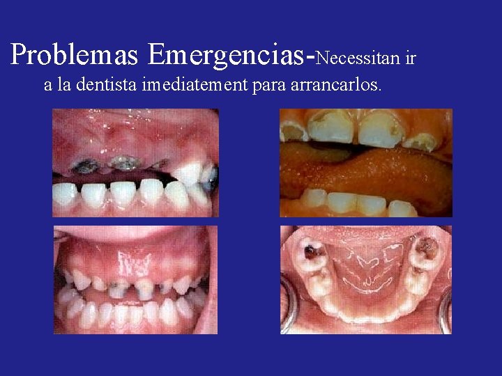 Problemas Emergencias-Necessitan ir a la dentista imediatement para arrancarlos. Problemas Emergencias-Necessitan ir a la dentista imediatement para arrancarlos.