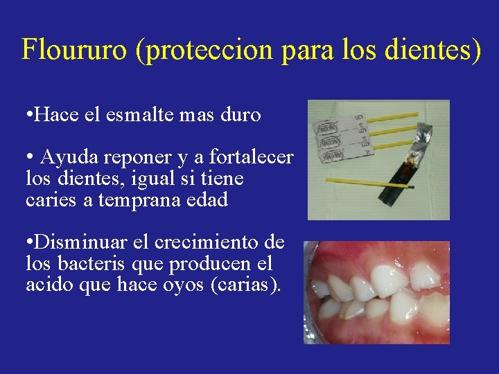 Floururo (proteccion para los dientes) • Hace el esmalte mas duro • Ayuda reponer Floururo (proteccion para los dientes) • Hace el esmalte mas duro • Ayuda reponer