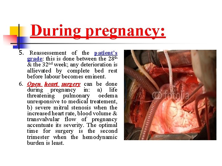 During pregnancy: 5. Reassessement of the patient’s grade: this is done between the 28