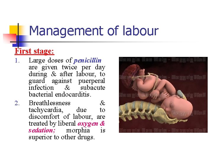 Management of labour First stage: 1. 2. Large doses of penicillin are given twice