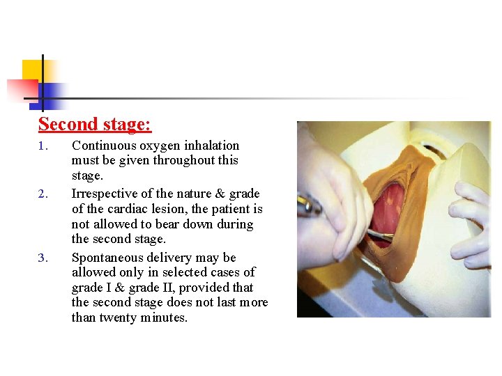 Second stage: 1. 2. 3. Continuous oxygen inhalation must be given throughout this stage.