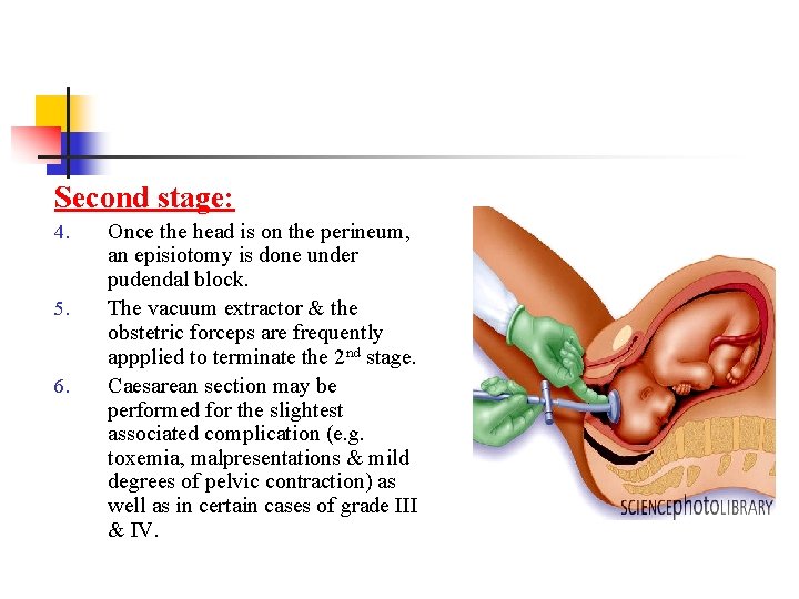 Second stage: 4. 5. 6. Once the head is on the perineum, an episiotomy
