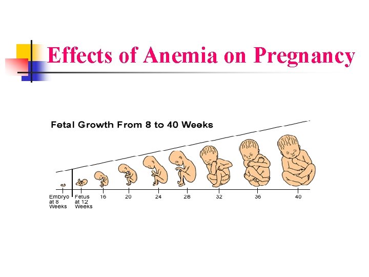 Effects of Anemia on Pregnancy 