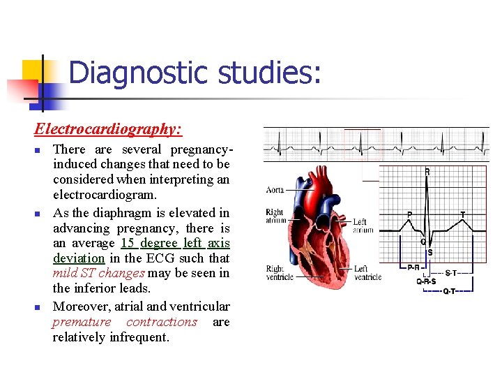 Diagnostic studies: Electrocardiography: n n n There are several pregnancyinduced changes that need to