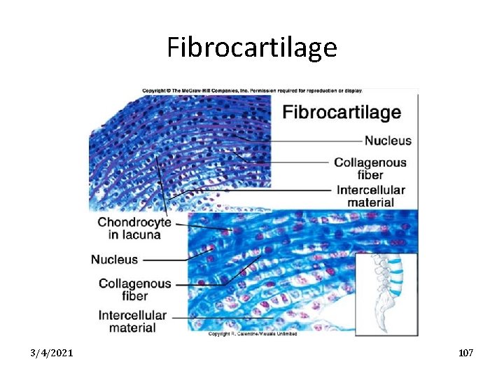 Fibrocartilage 3/4/2021 107 