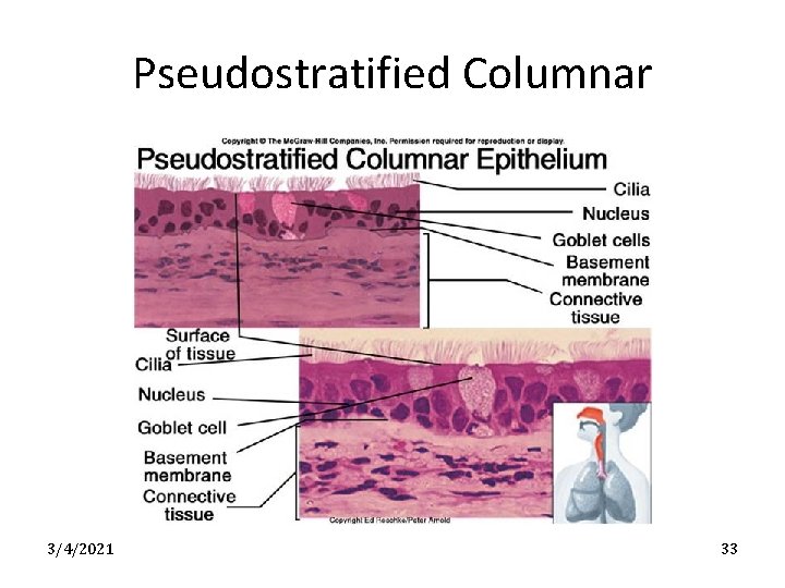 Pseudostratified Columnar 3/4/2021 33 