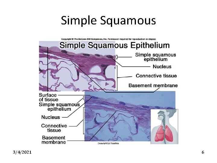 Simple Squamous 3/4/2021 6 