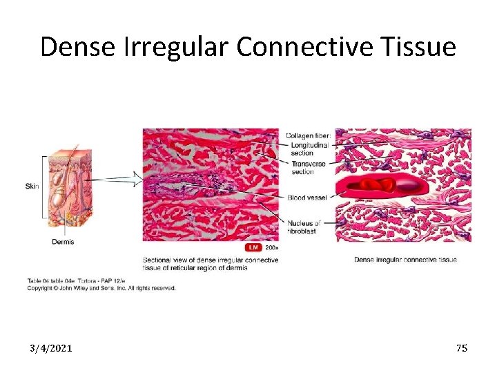 Dense Irregular Connective Tissue 3/4/2021 75 