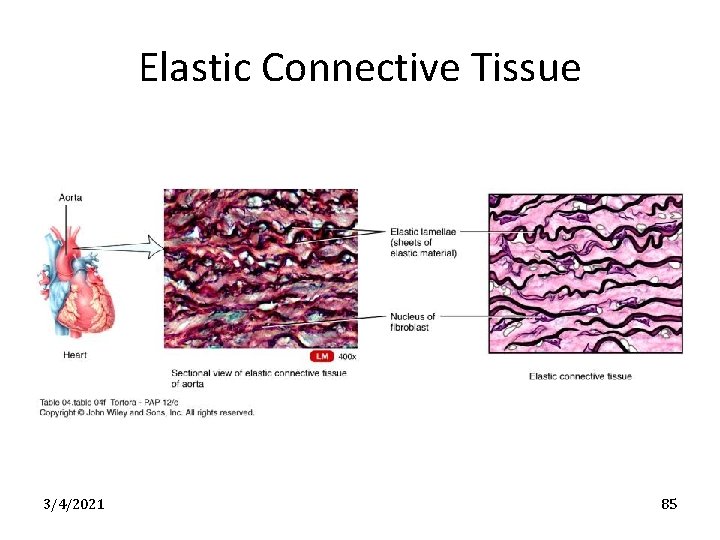 Elastic Connective Tissue 3/4/2021 85 