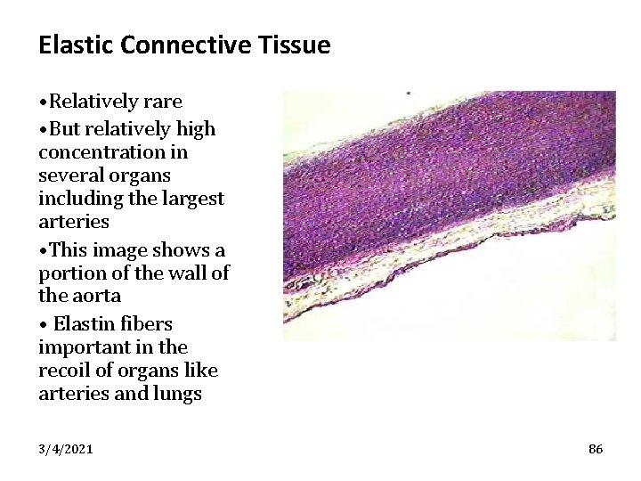 Elastic Connective Tissue • Relatively rare • But relatively high concentration in several organs