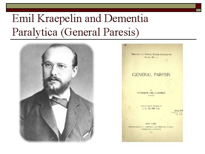 Emil Kraepelin and Dementia Paralytica (General Paresis) 