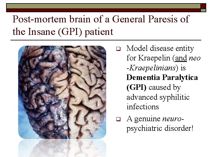 Post-mortem brain of a General Paresis of the Insane (GPI) patient q q Model