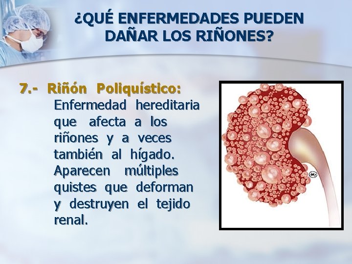 ¿QUÉ ENFERMEDADES PUEDEN DAÑAR LOS RIÑONES? 7. - Riñón Poliquístico: Enfermedad hereditaria que afecta