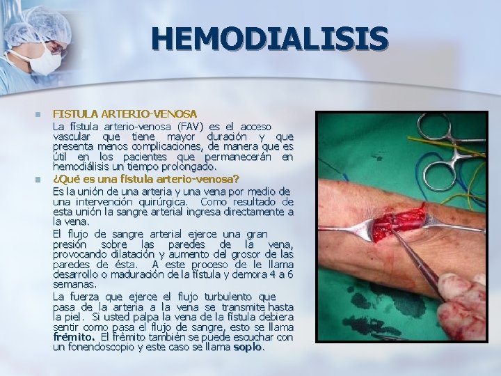 HEMODIALISIS n n FISTULA ARTERIO-VENOSA La fístula arterio-venosa (FAV) es el acceso vascular que