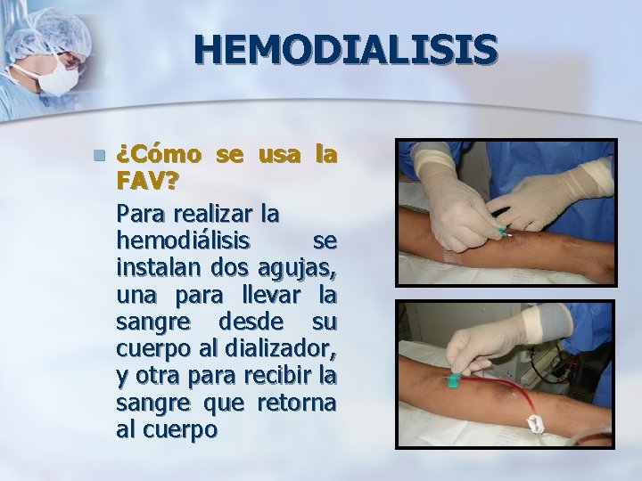 HEMODIALISIS n ¿Cómo se usa la FAV? Para realizar la hemodiálisis se instalan dos