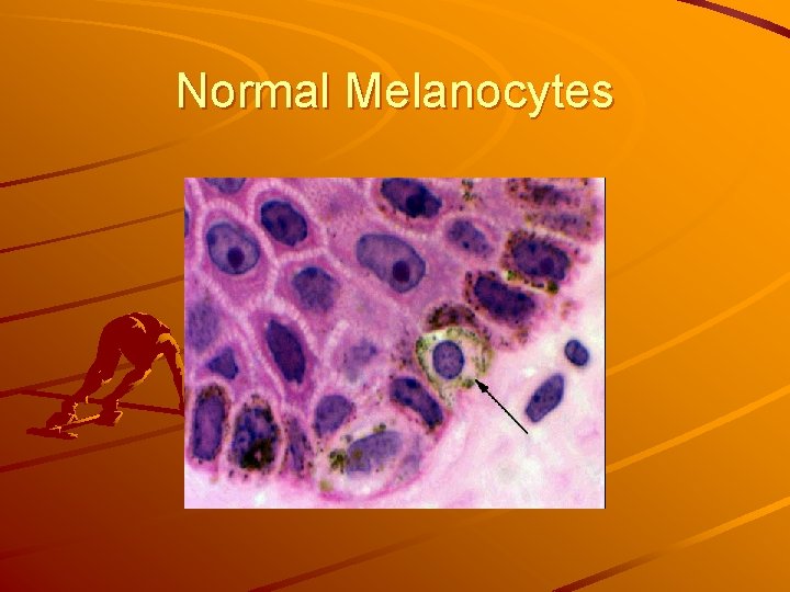 Normal Melanocytes 