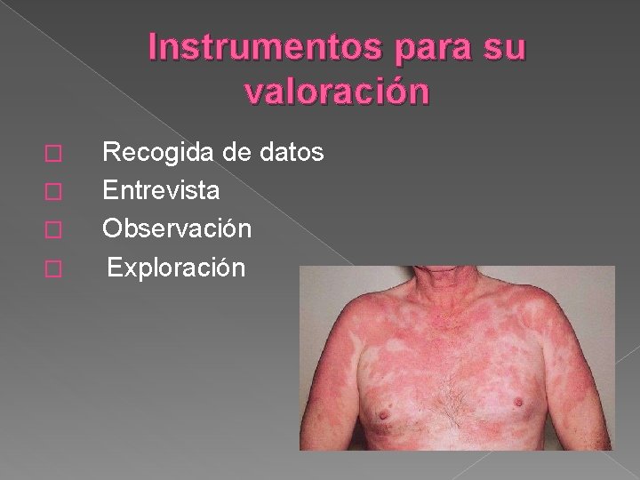Instrumentos para su valoración Recogida de datos � Entrevista � Observación � Exploración � Instrumentos para su valoración Recogida de datos � Entrevista � Observación � Exploración �
