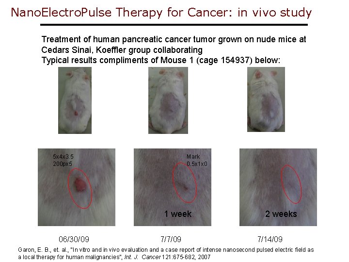 Nano. Electro. Pulse Therapy for Cancer: in vivo study Treatment of human pancreatic cancer