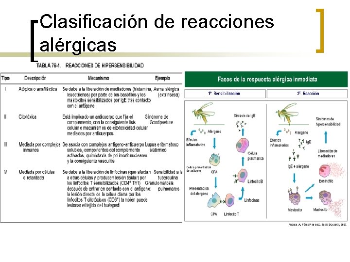 Clasificación de reacciones alérgicas Clasificación de reacciones alérgicas