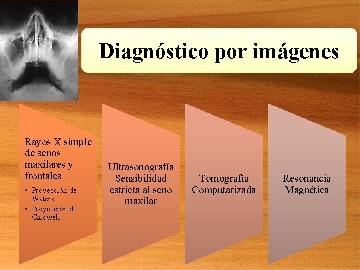 Diagnóstico por imágenes Rayos X simple de senos maxilares y frontales • Proyección de