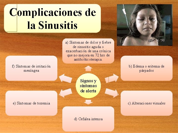 Complicaciones de la Sinusitis a) Síntomas de dolor y fiebre de sinusitis aguda o