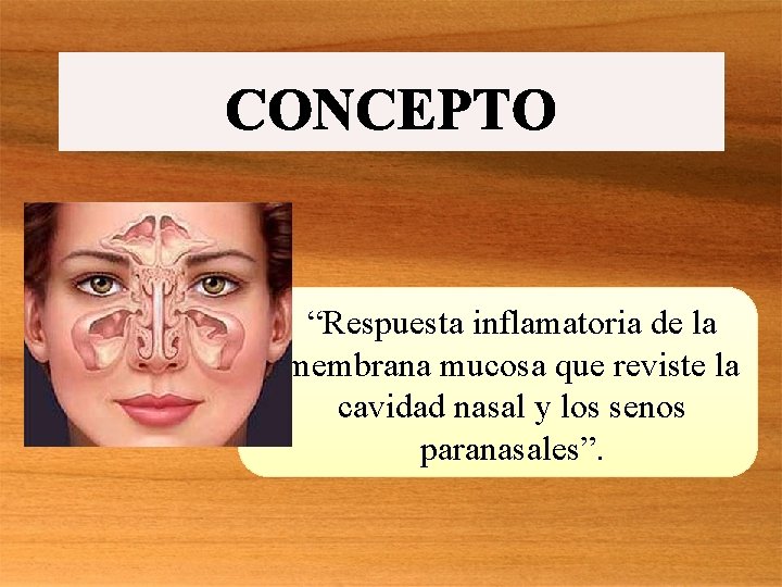 “Respuesta inflamatoria de la membrana mucosa que reviste la cavidad nasal y los senos