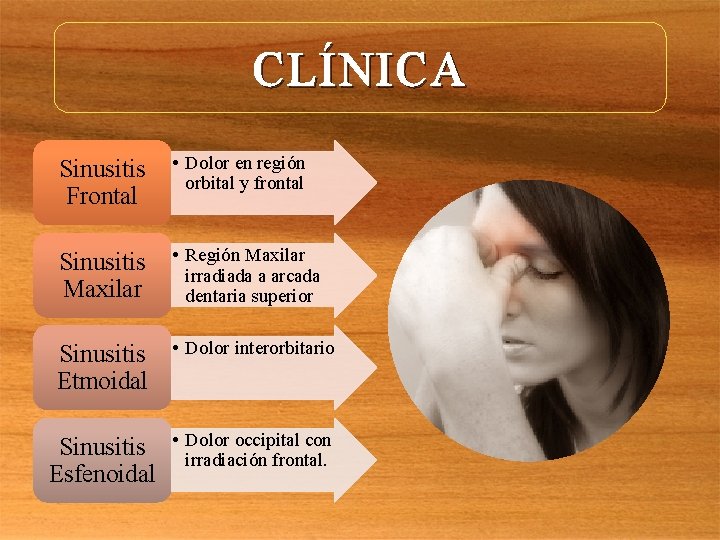 CLÍNICA Sinusitis Frontal • Dolor en región orbital y frontal Sinusitis Maxilar • Región
