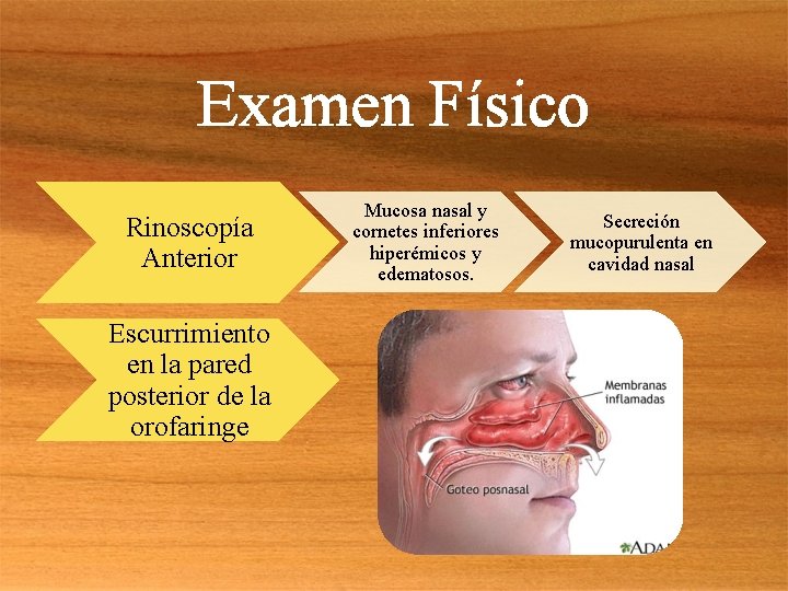 Examen Físico Rinoscopía Anterior Escurrimiento en la pared posterior de la orofaringe Mucosa nasal