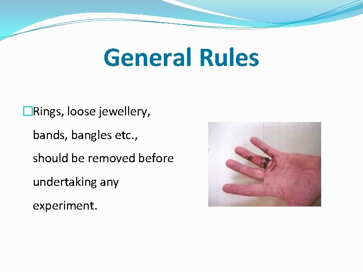 General Rules �Rings, loose jewellery, bands, bangles etc. , should be removed before undertaking