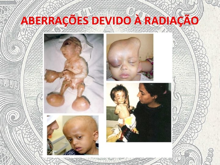 ABERRAÇÕES DEVIDO À RADIAÇÃO 