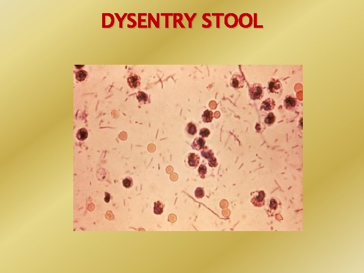 SALMONELLA SHIGELLA GIT BLOCK Prof Ali Somily Prof