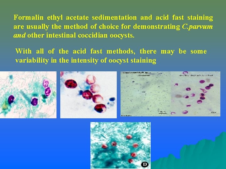 Formalin ethyl acetate sedimentation and acid fast staining are usually the method of choice