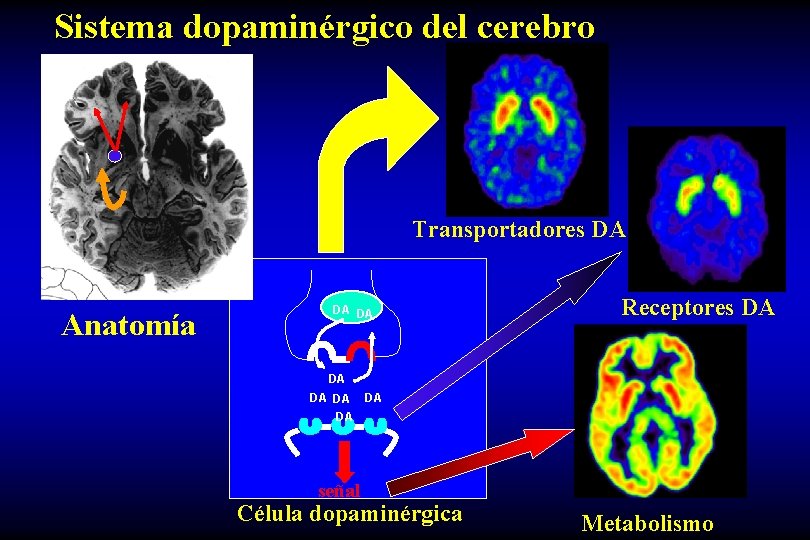 Sistema dopaminérgico del cerebro Transportadores DA Anatomía DA DA Receptores DA DA DA señal