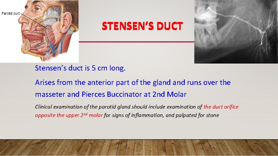 STENSEN’S DUCT Stensen’s duct is 5 cm long. Arises from the anterior part of