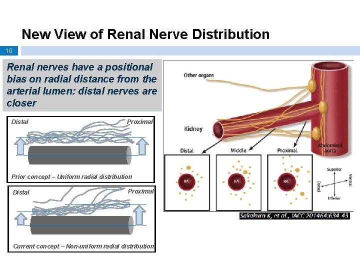 New View of Renal Nerve Distribution 10 Renal nerves have a positional bias on