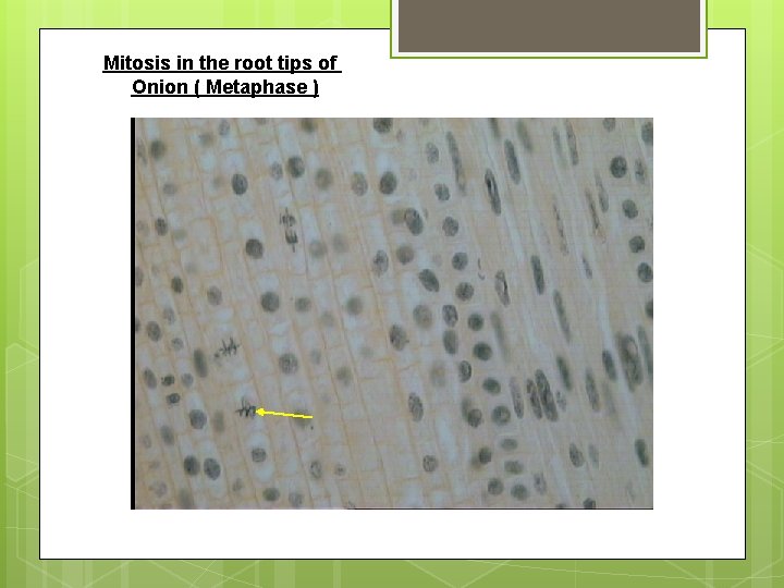 Mitosis in the root tips of Onion ( Metaphase ) 