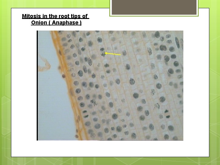 Mitosis in the root tips of Onion ( Anaphase ) 