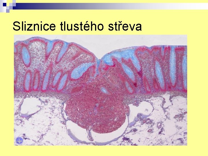 Sliznice tlustého střeva 