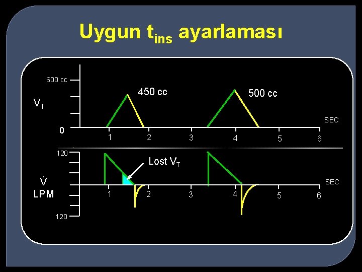 Uygun tins ayarlaması 600 cc 450 cc VT 500 cc SEC 0 1 120