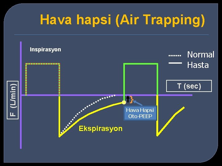 Hava hapsi (Air Trapping) Inspirasyon Normal Hasta F (L/min) T (sec) } Hava Hapsi