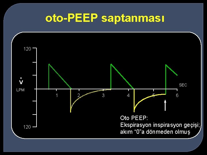 oto-PEEP saptanması 120 . V SEC LPM 1 120 2 3 4 5 6