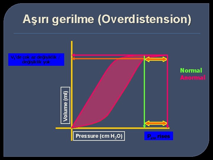 Aşırı gerilme (Overdistension) VT’de çok az değişiklik / değişiklik yok Volume (ml) Normal Anormal
