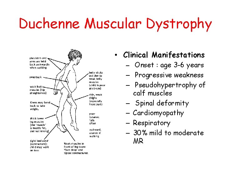 Duchenne Muscular Dystrophy • Clinical Manifestations – Onset : age 3 -6 years –