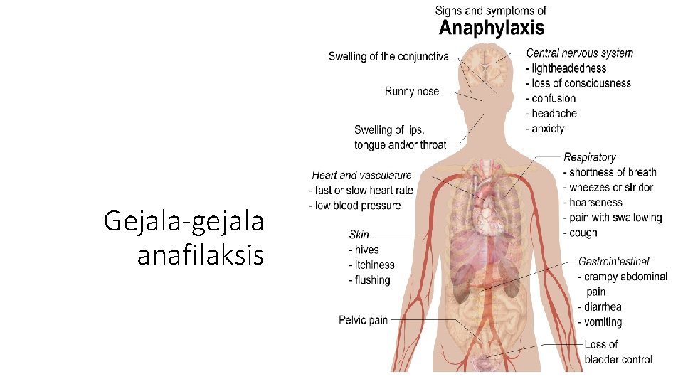 Gejala-gejala anafilaksis 